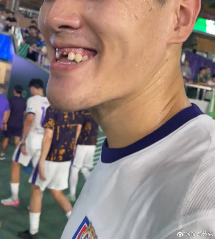 记者：王献均门牙留在了黄龙体育中心，很多人一起找都没找到